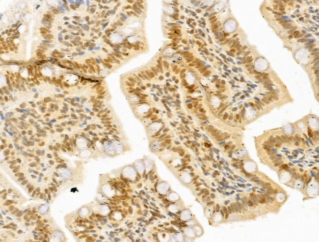 PTPN23 Antibody in Immunohistochemistry (Paraffin) (IHC (P))