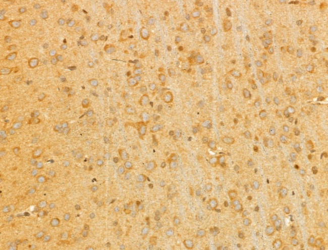 PTPN23 Antibody in Immunohistochemistry (Paraffin) (IHC (P))