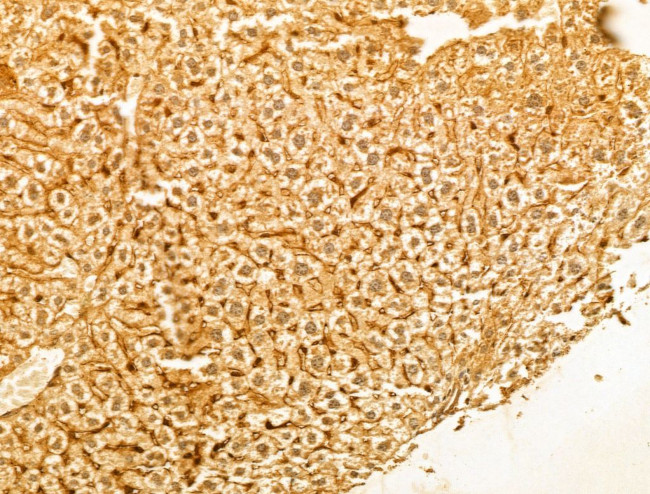 PTPN23 Antibody in Immunohistochemistry (Paraffin) (IHC (P))