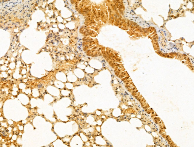 PTPN23 Antibody in Immunohistochemistry (Paraffin) (IHC (P))