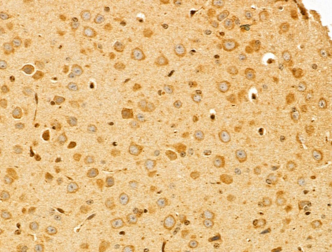 PTPN23 Antibody in Immunohistochemistry (Paraffin) (IHC (P))