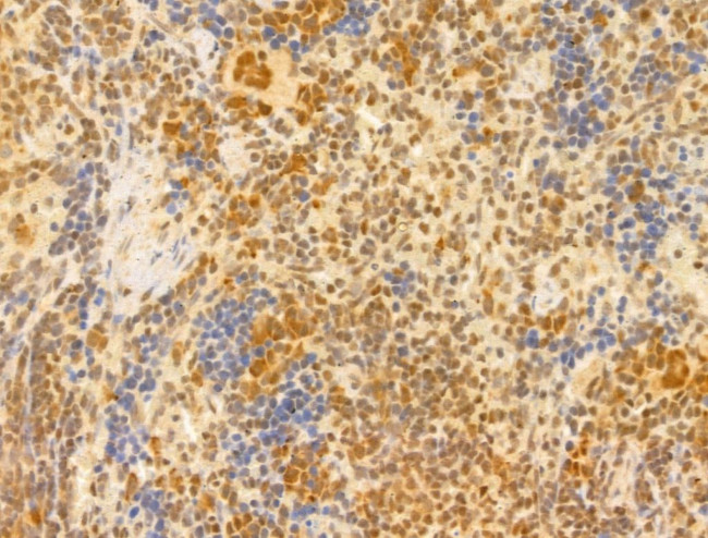 PTPN23 Antibody in Immunohistochemistry (Paraffin) (IHC (P))