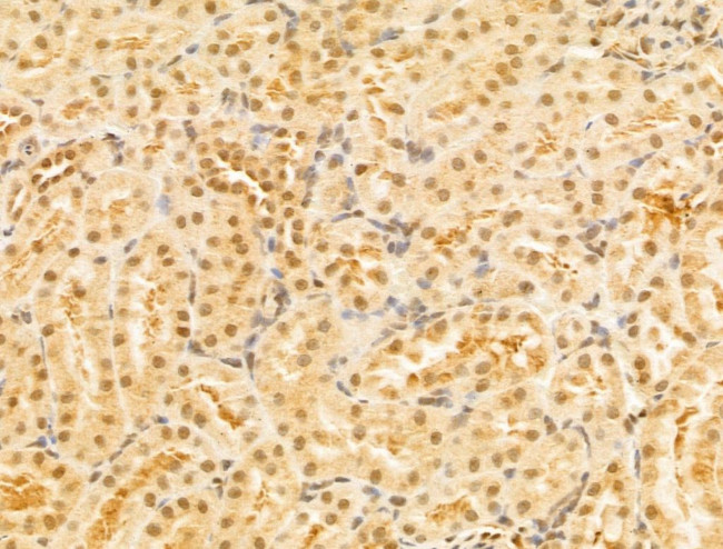 PTPN23 Antibody in Immunohistochemistry (Paraffin) (IHC (P))