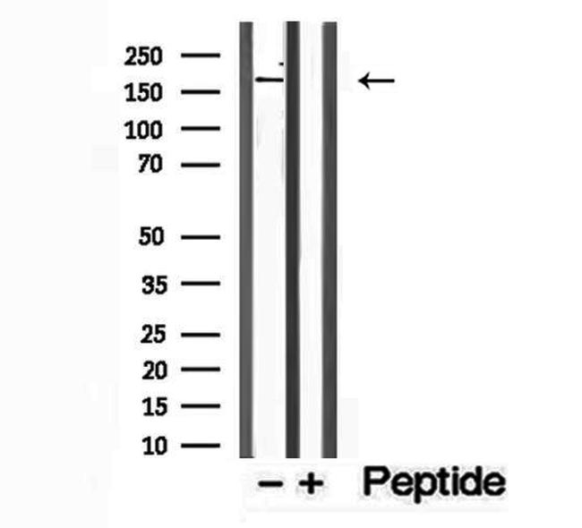 PTPN23 Antibody in Western Blot (WB)