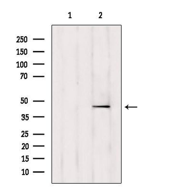 TTLL6 Antibody in Western Blot (WB)