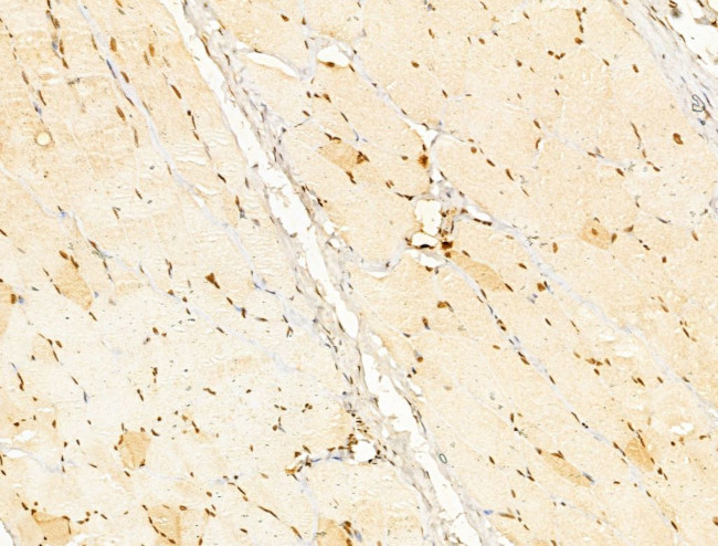 USP39 Antibody in Immunohistochemistry (Paraffin) (IHC (P))