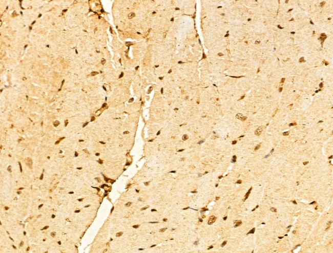 USP39 Antibody in Immunohistochemistry (Paraffin) (IHC (P))