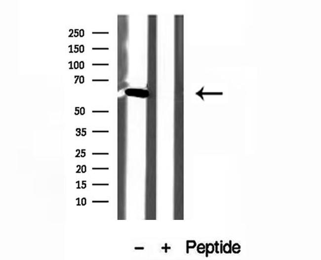 USP39 Antibody in Western Blot (WB)