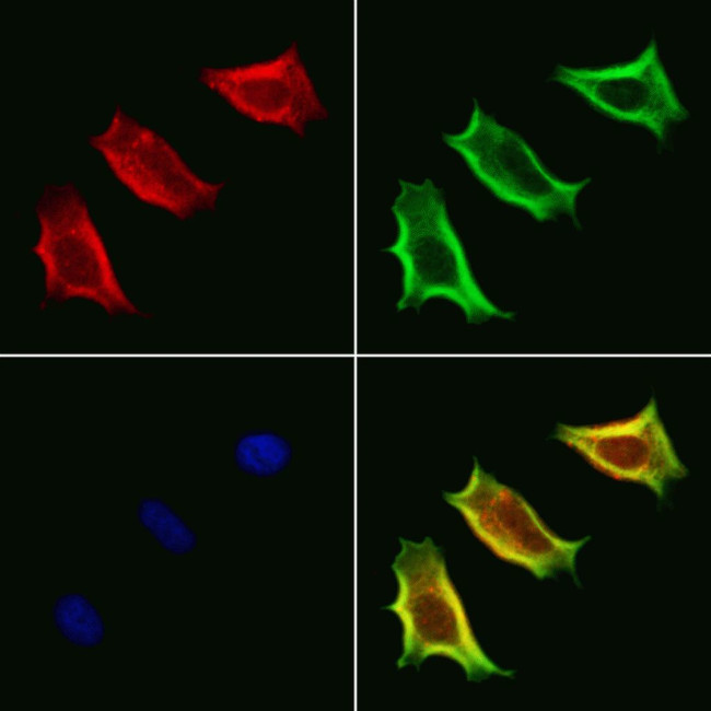 VPS33B Antibody in Immunocytochemistry (ICC/IF)