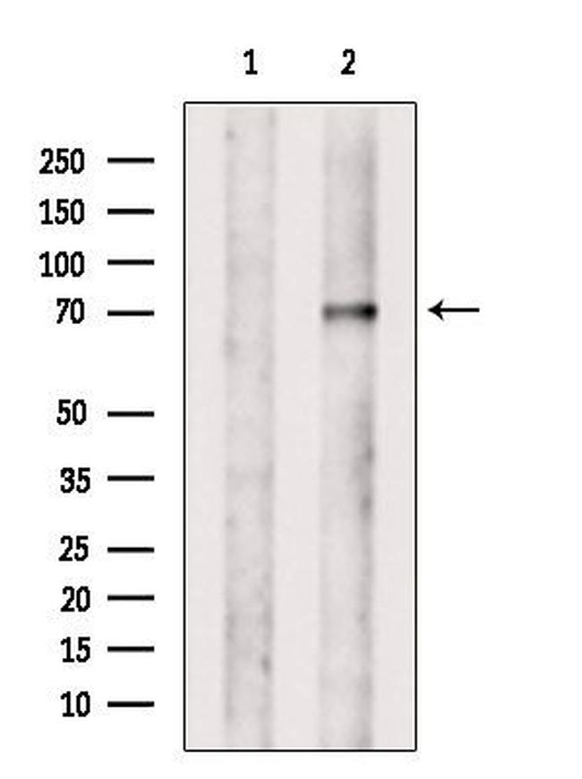 VPS33B Antibody in Western Blot (WB)