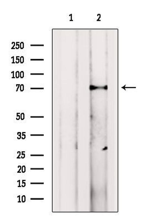 VPS33B Antibody in Western Blot (WB)