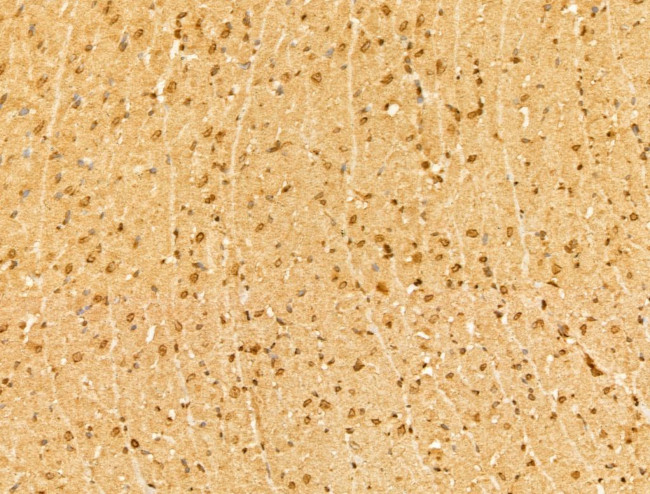 YTHDF2 Antibody in Immunohistochemistry (Paraffin) (IHC (P))