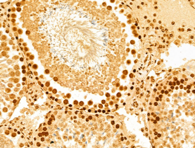 YTHDF2 Antibody in Immunohistochemistry (Paraffin) (IHC (P))