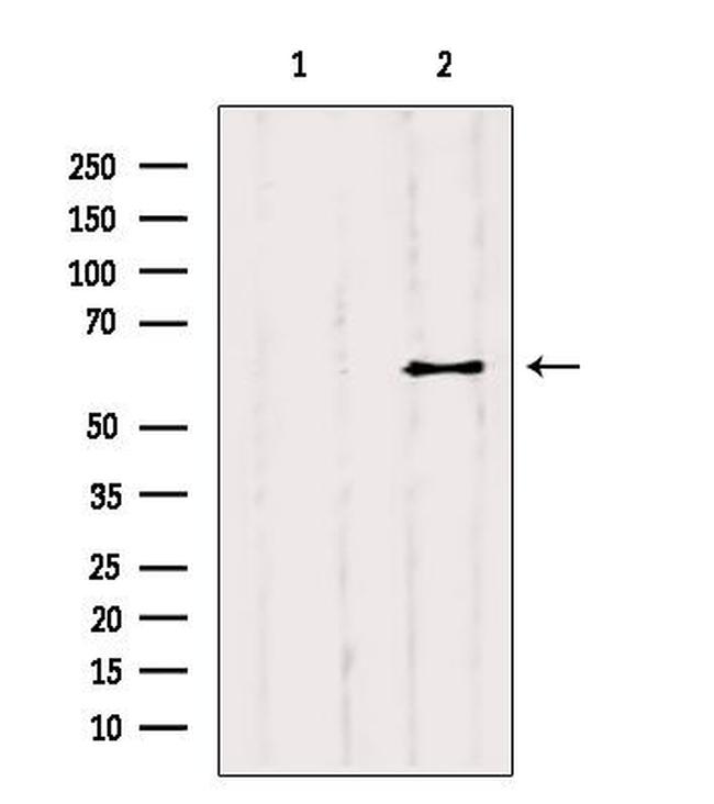 YTHDF2 Antibody in Western Blot (WB)