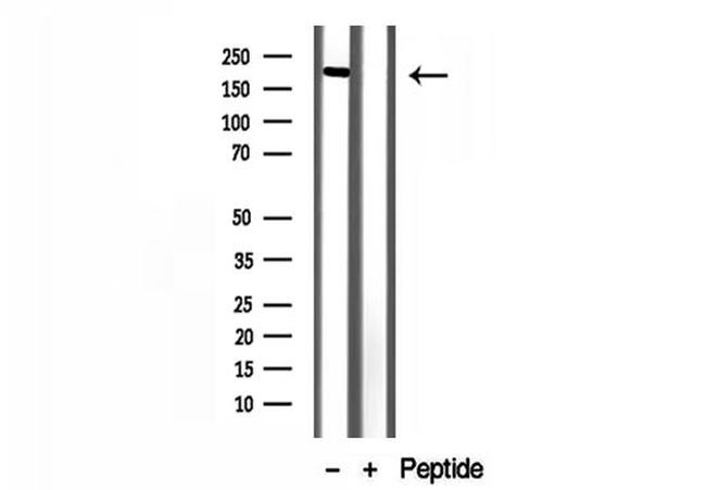 ZCCHC11 Antibody in Western Blot (WB)