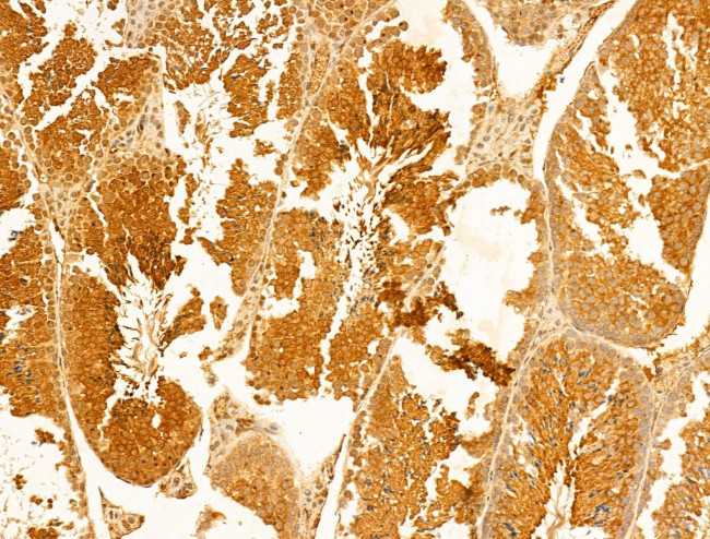 ACADS Antibody in Immunohistochemistry (Paraffin) (IHC (P))