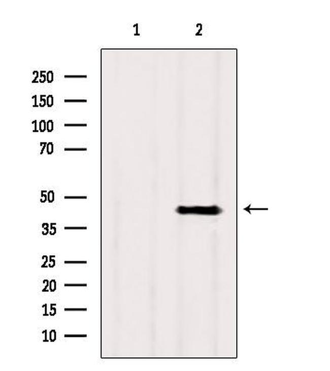 ACADS Antibody in Western Blot (WB)