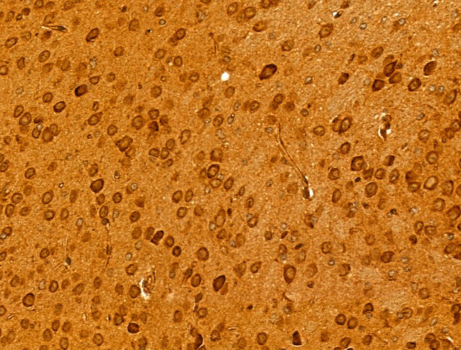 BCS1L Antibody in Immunohistochemistry (Paraffin) (IHC (P))