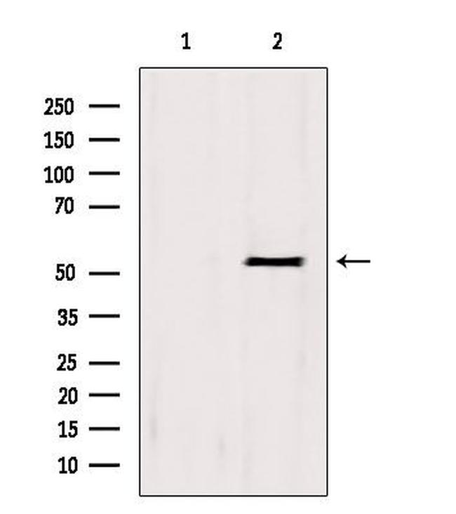 BCS1L Antibody in Western Blot (WB)