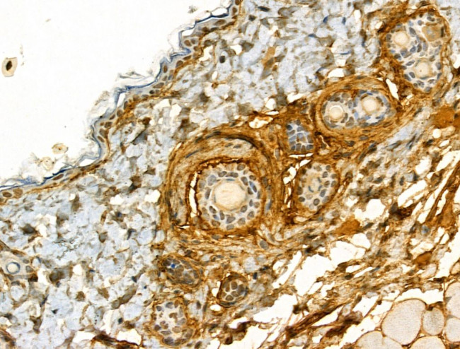 COL6A1 Antibody in Immunohistochemistry (Paraffin) (IHC (P))