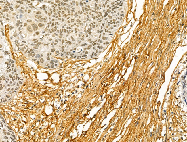 COL6A1 Antibody in Immunohistochemistry (Paraffin) (IHC (P))