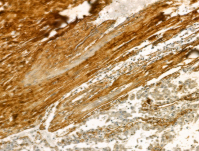 COL6A1 Antibody in Immunohistochemistry (Paraffin) (IHC (P))