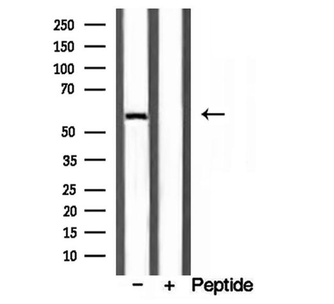 D2HGDH Antibody in Western Blot (WB)