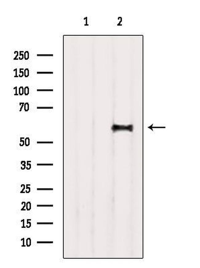 D2HGDH Antibody in Western Blot (WB)