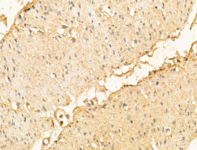 DPT Antibody in Immunohistochemistry (Paraffin) (IHC (P))