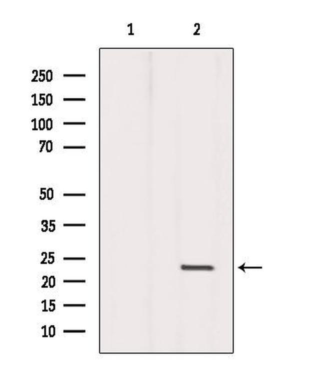 DPT Antibody in Western Blot (WB)