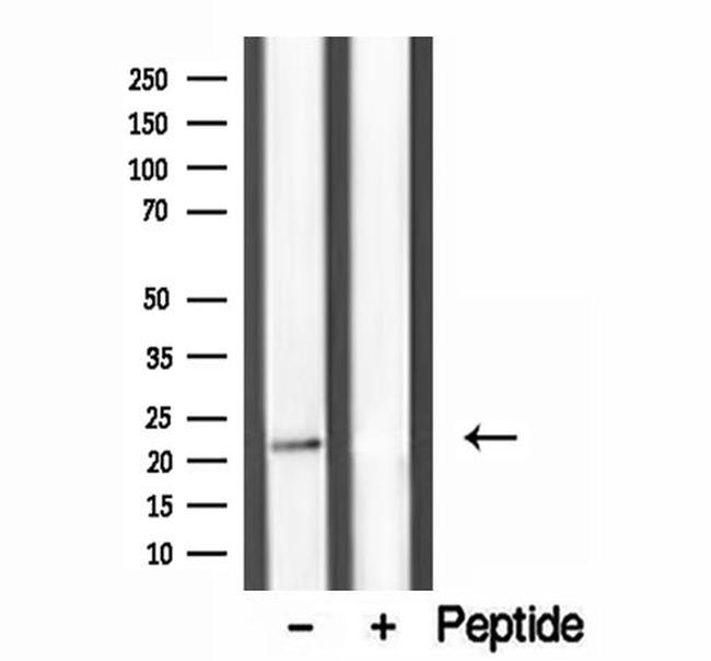 DPT Antibody in Western Blot (WB)