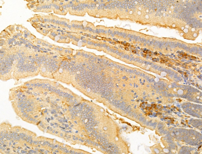 ERO1LB Antibody in Immunohistochemistry (Paraffin) (IHC (P))