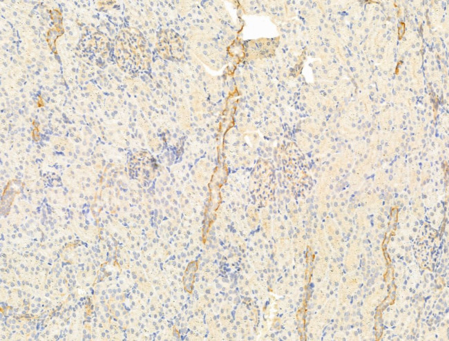 ERO1LB Antibody in Immunohistochemistry (Paraffin) (IHC (P))