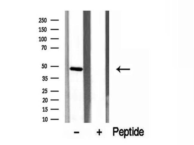 ERO1LB Antibody in Western Blot (WB)