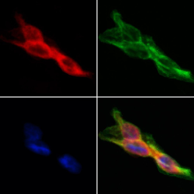 HLA-F Antibody in Immunocytochemistry (ICC/IF)