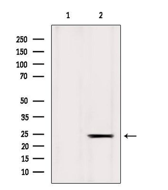 ICT1 Antibody in Western Blot (WB)