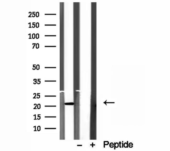 ICT1 Antibody in Western Blot (WB)