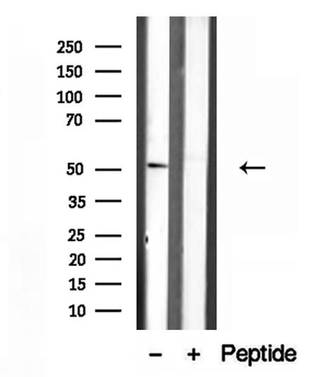 IFT52 Antibody in Western Blot (WB)