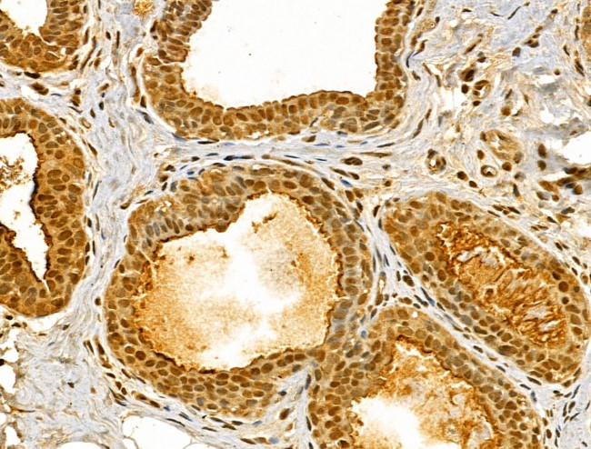 Importin 4 Antibody in Immunohistochemistry (Paraffin) (IHC (P))