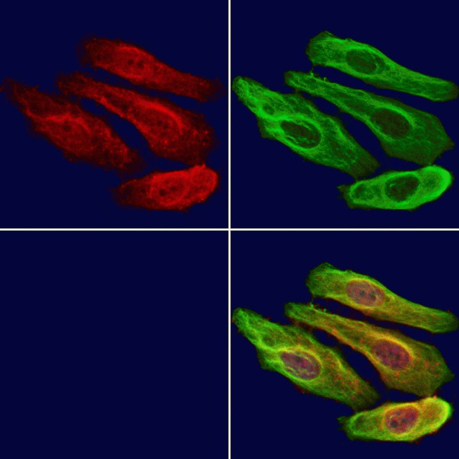 Importin 4 Antibody in Immunocytochemistry (ICC/IF)