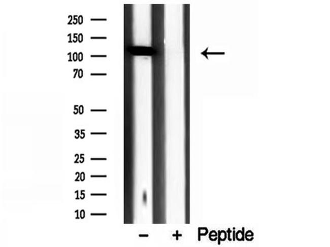 Importin 4 Antibody in Western Blot (WB)