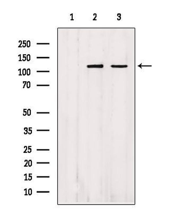 Importin 4 Antibody in Western Blot (WB)