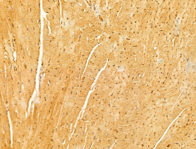 MAVS Antibody in Immunohistochemistry (Paraffin) (IHC (P))