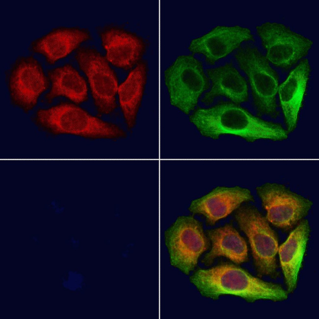 NAPRT1 Antibody in Immunocytochemistry (ICC/IF)