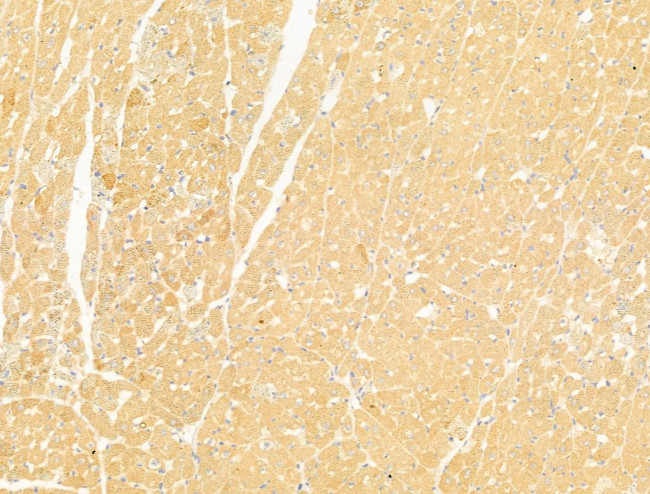 NAPRT1 Antibody in Immunohistochemistry (Paraffin) (IHC (P))