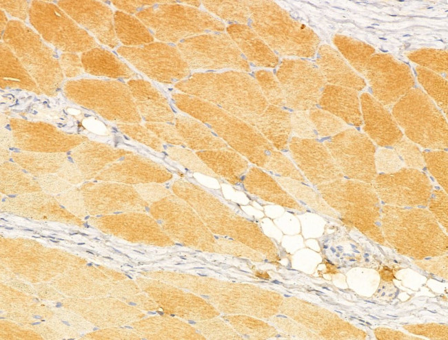 NAPRT1 Antibody in Immunohistochemistry (Paraffin) (IHC (P))