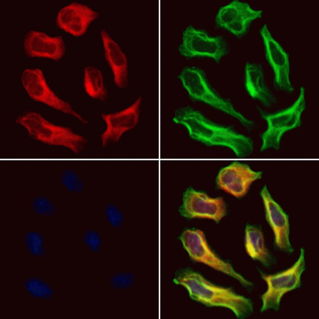 SEPT9 Antibody in Immunocytochemistry (ICC/IF)