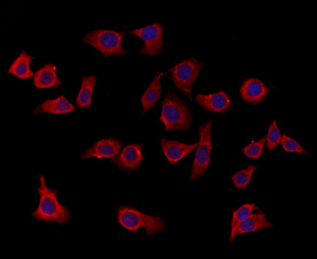 SEPT9 Antibody in Immunocytochemistry (ICC/IF)