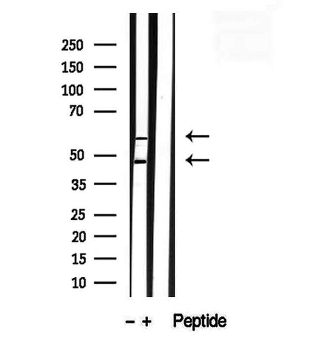 SEPT9 Antibody in Western Blot (WB)