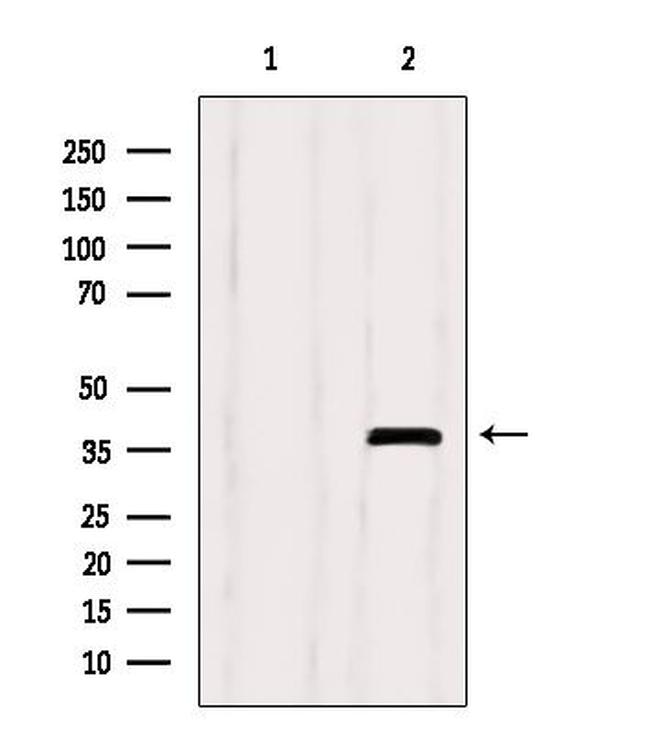 SEPT9 Antibody in Western Blot (WB)